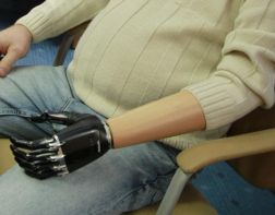 В Пензе пациенту поставили уникальный протез за 4 млн рублей